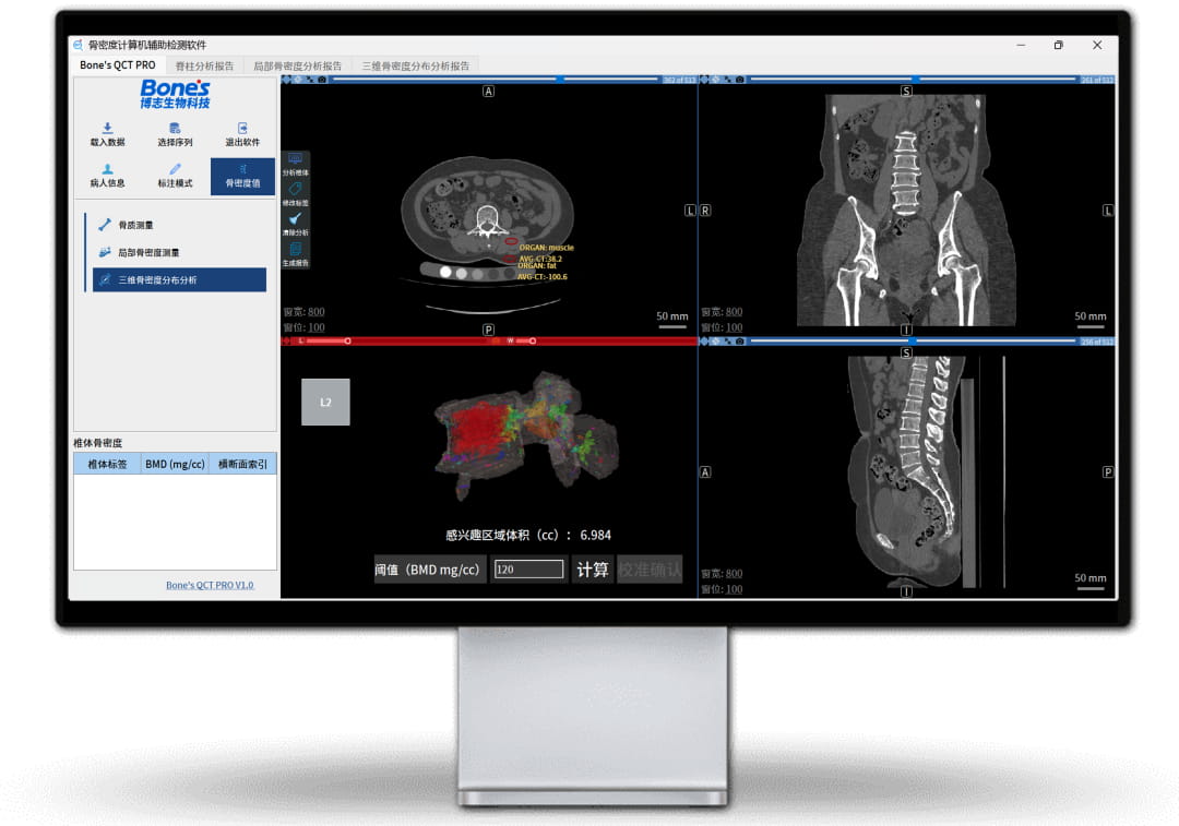 BONES TECHNOLOGY LIMITEDProductImg12475de82-c1f6-e811-8119-0050569afff2_ProductImage1_16072026