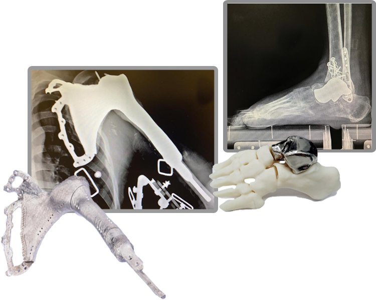 Koln 3D Technology Medical LimitedProductImg1product_image