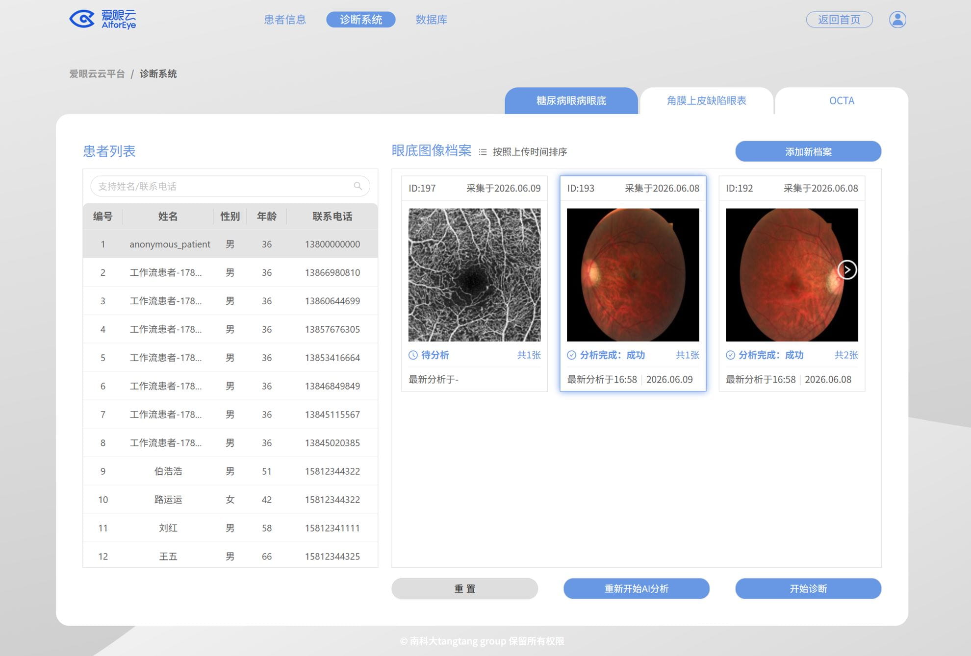 AI OF EYE LIMITEDProductImg28d485792-715a-f111-a825-00224858ee6b_ProductImage2_25062026