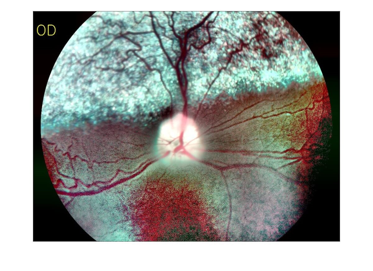 dog-dau-dau-_retinal-image