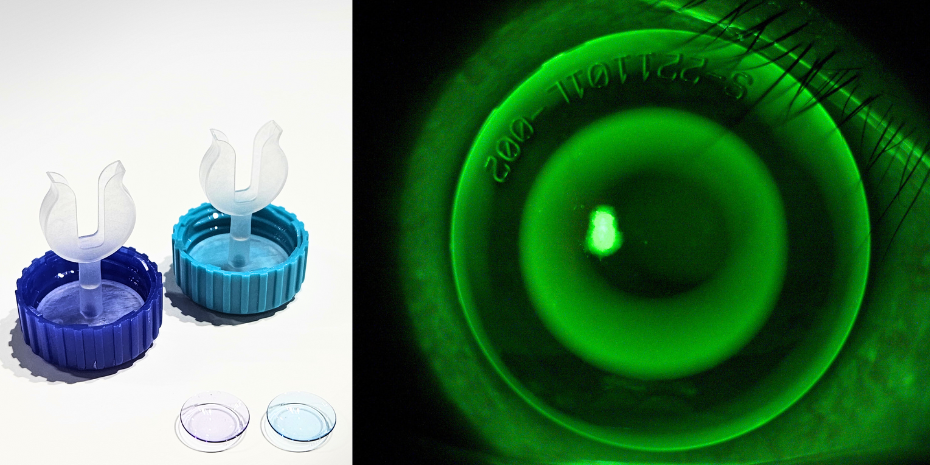 detail_pic_for_hkstp_ok_lens